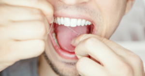 The process of treating something that is caught between teeth is a common dental procedure. 